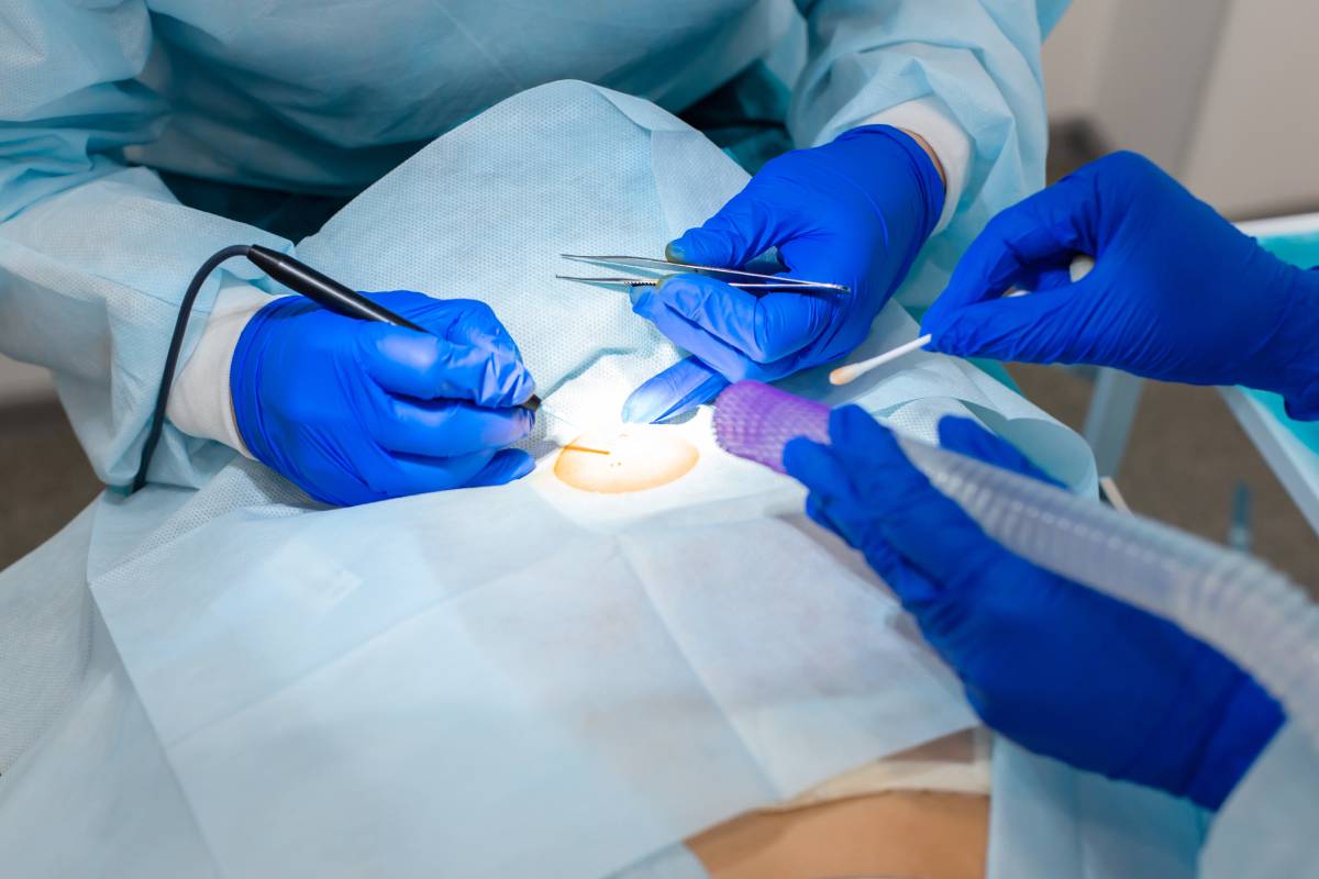 Anesthesia Management of Skin Cancer Surgery