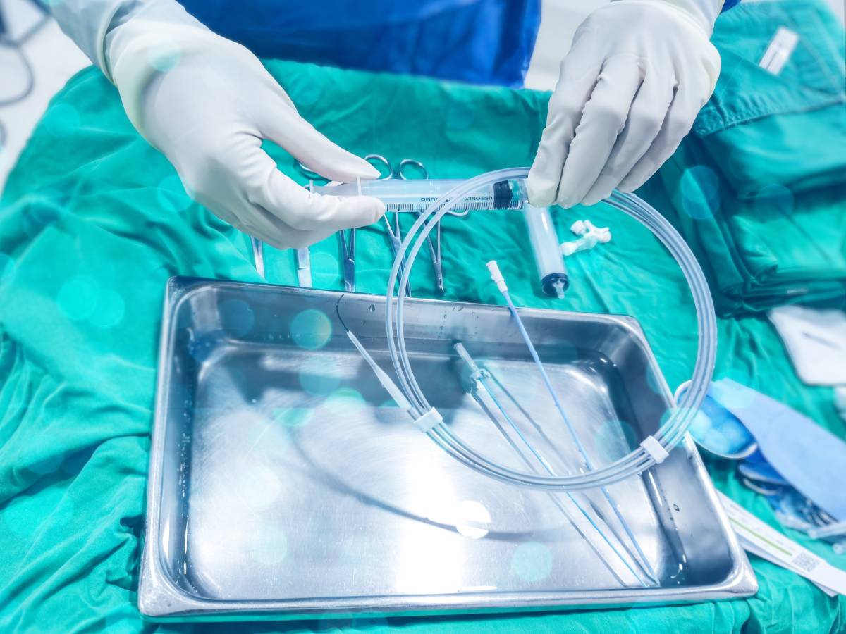 Longevity of Catheters for Regional Anesthesia