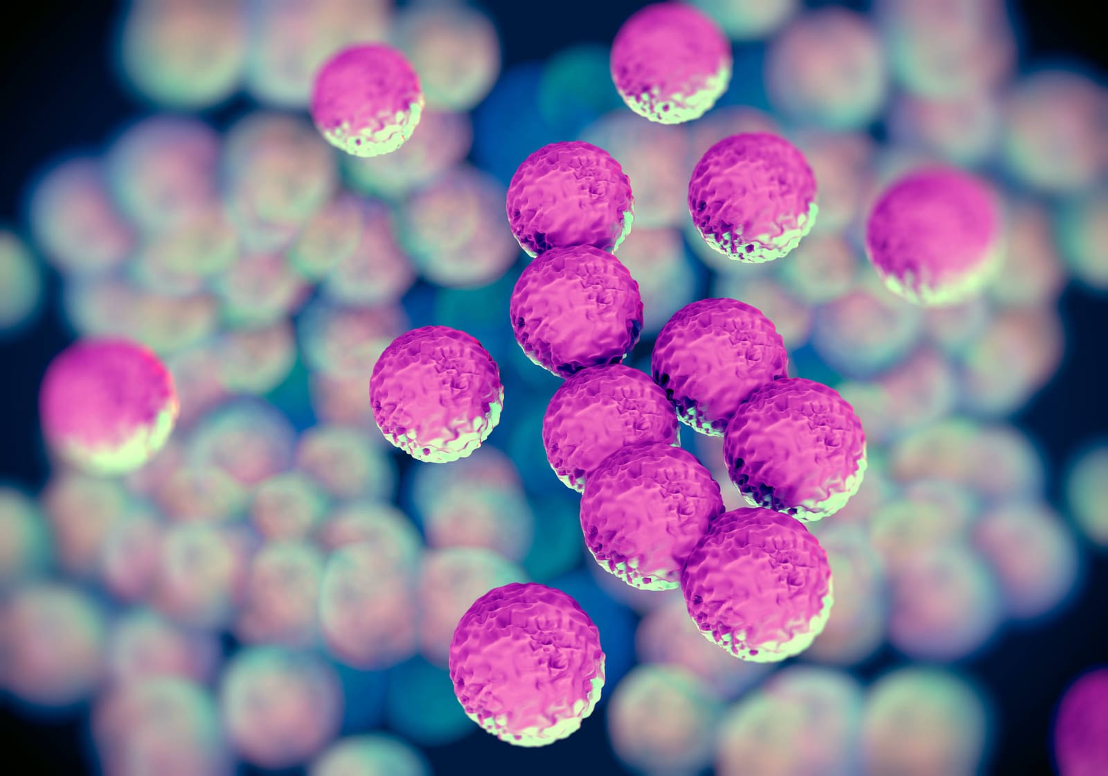 MRSA: An Overview