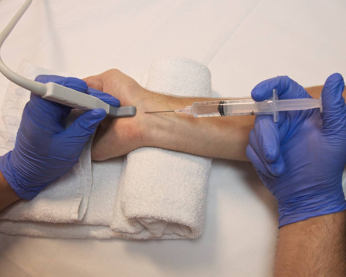 Neurological Conditions Following Nerve Blocks